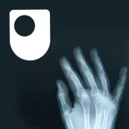 Rheumatoid arthritis - a long term condition - for iPad/Mac/PC Podcast artwork