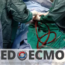 ED ECMO