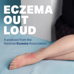 Eczema Out Loud Podcast artwork