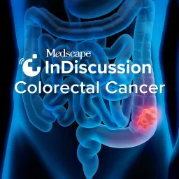 Medscape InDiscussion: Colorectal Cancer